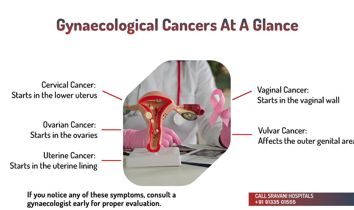 gynaecological-cancers-at-a-glance