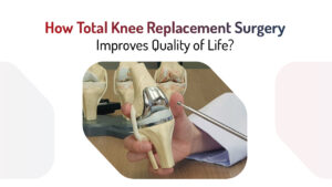 how-total-knee-replacement-surgery-improves-quality-of-life
